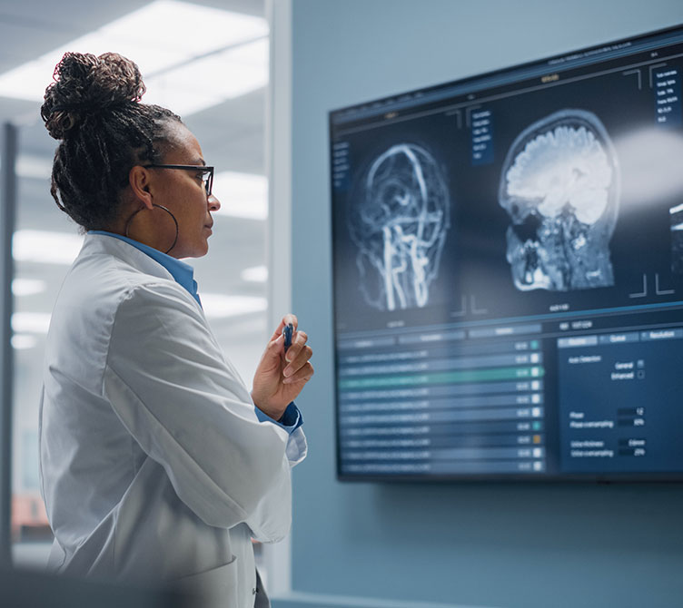 Medical Science Hospital: Confident Black Female Neurologist, Neuroscientist, Neurosurgeon, Looks at TV Screen with MRI Scan with Brain Images, Thinks about Sick Patient Treatment Method. Saving Lives.