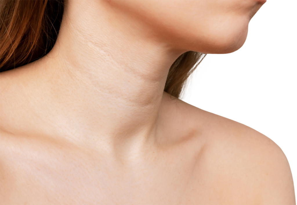 Cropped shot of a young woman with lines on her neck
